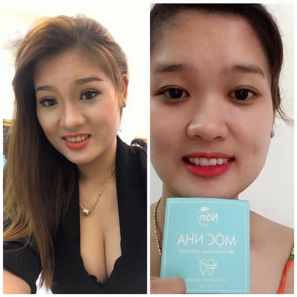 Bột trắng răng Mộc Nha có tốt không?